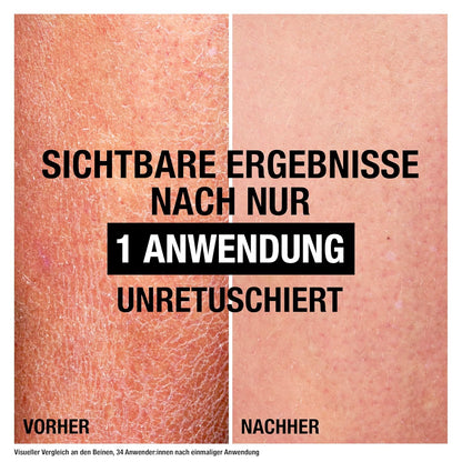 Neutrogena Deep Moisture Bodylotion Sensitive, Parfümfreie Körperlotion Für Empfindliche, Trockene Haut, Nicht Fettende Hautpflege Lotion Mit Glycerin & Pro-Ceramide Technologie (250 Ml)