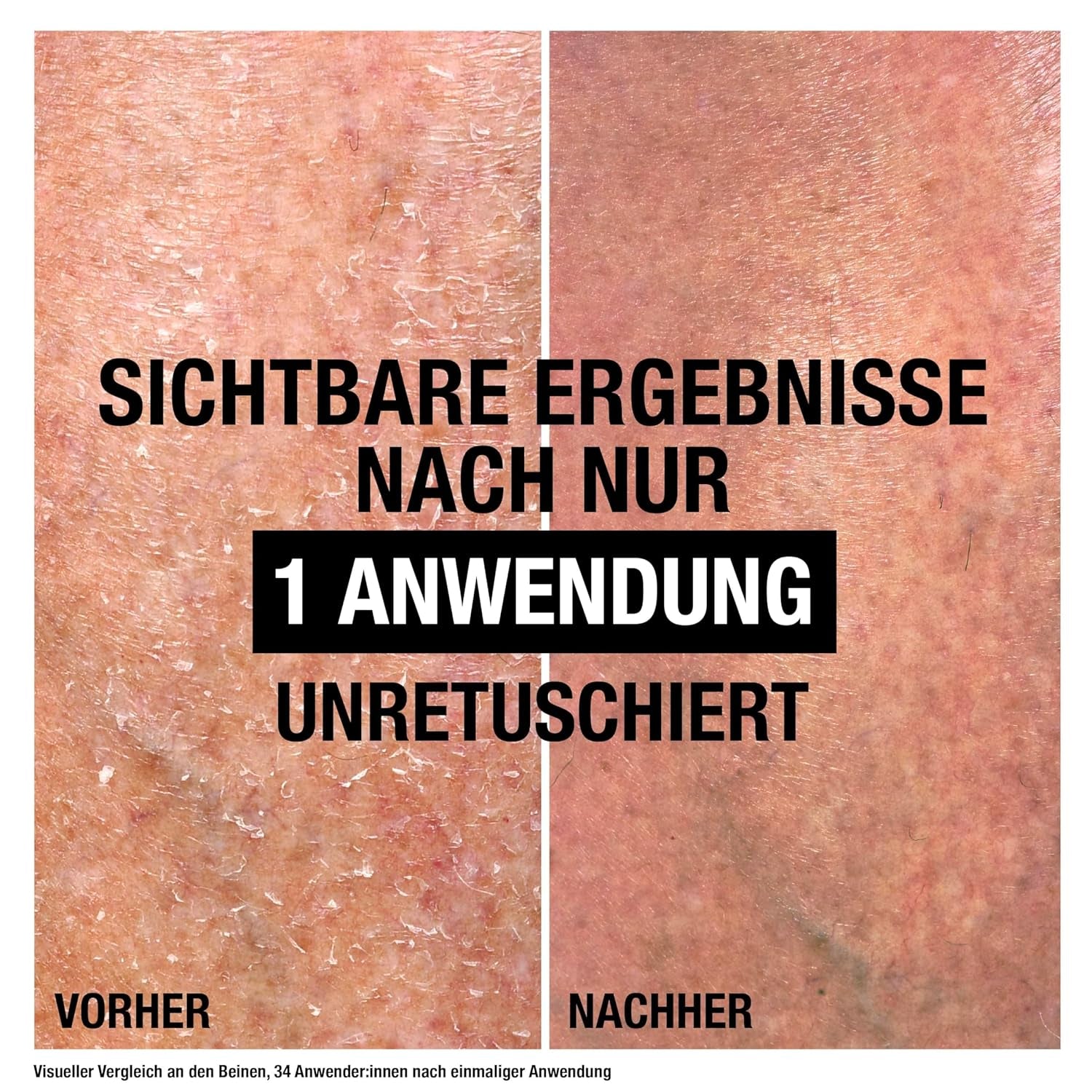 Neutrogena Intense Repair Reparierender CICA Bodybalsam, Feuchtigkeitsspendende Bodylotion Mit Glycerin & Centella Asiatica, Nicht Fettende Körperlotion Für Raue, Sehr Trockene Haut (250 Ml)