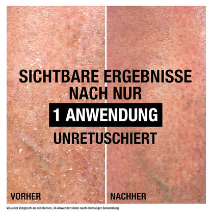 Neutrogena Intense Repair Reparierender CICA Bodybalsam, Feuchtigkeitsspendende Bodylotion Mit Glycerin & Centella Asiatica, Nicht Fettende Körperlotion Für Raue, Sehr Trockene Haut (250 Ml)